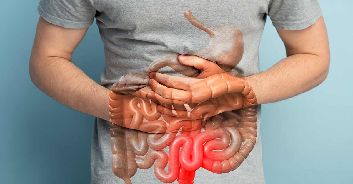 Intestino preso
